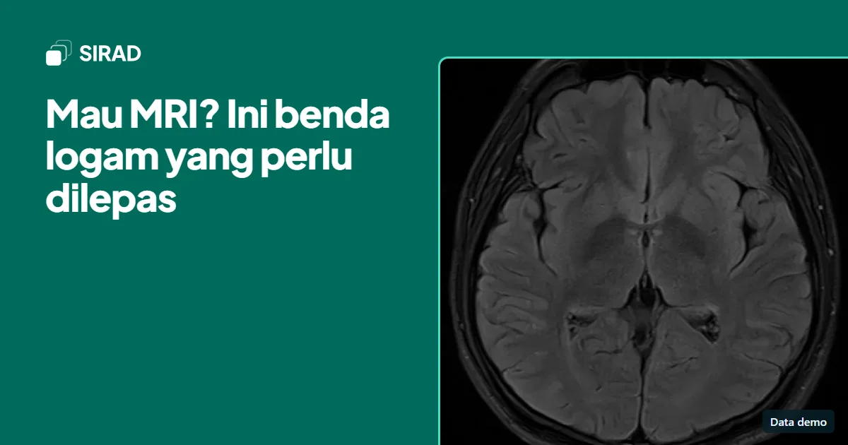 Judul artikel di samping potongan MRI kepala, dengan data demo.